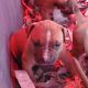 Dogue De Bordeaux Puppies for sale in East Haven, CT 06512, USA. price: NA